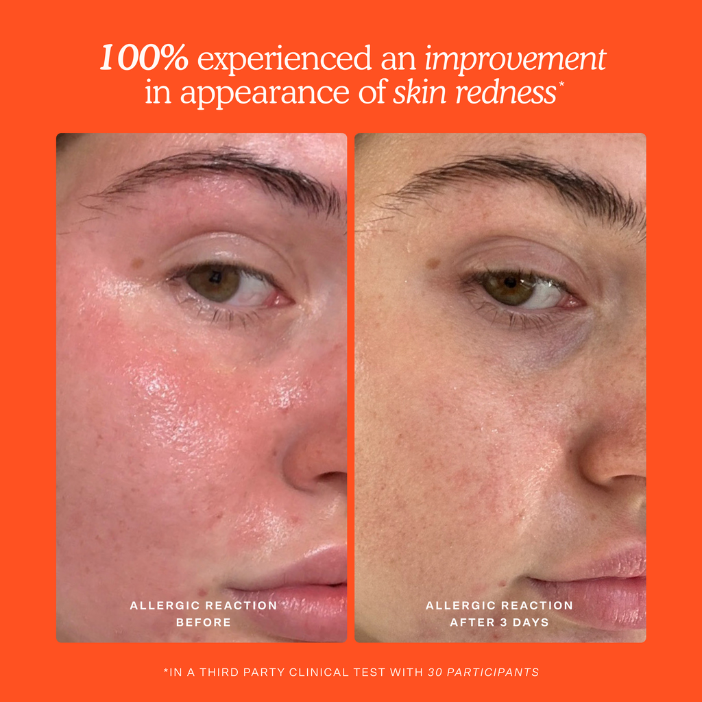 SOS Rescue Spray - Standard Size